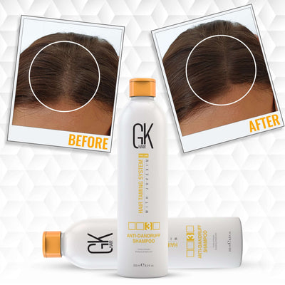 GK Hair Anti Dandruff Shampoo Best Result 